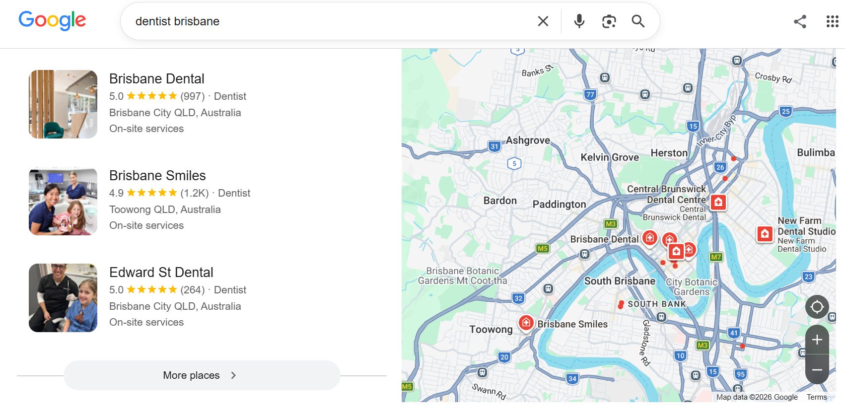 Google's local map pack for "dentist brisbane" showing three top-rated Brisbane dental clinics with review counts and a map — the local search that regular SEO can't win